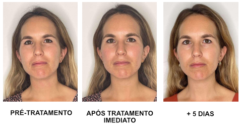 protocolo revitalizante