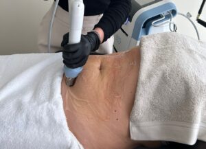 abdomen BTL X-wave