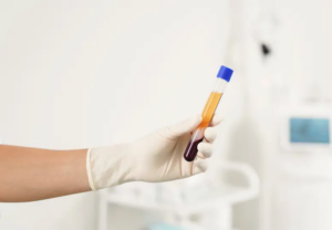 Medicina Desportiva. Atletas profissionais e amadores beneficiam do PRP no tratamento de lesões desportivas, como distensões musculares, entorses e lesões ligamentares. Promove uma recuperação mais rápida e eficiente.