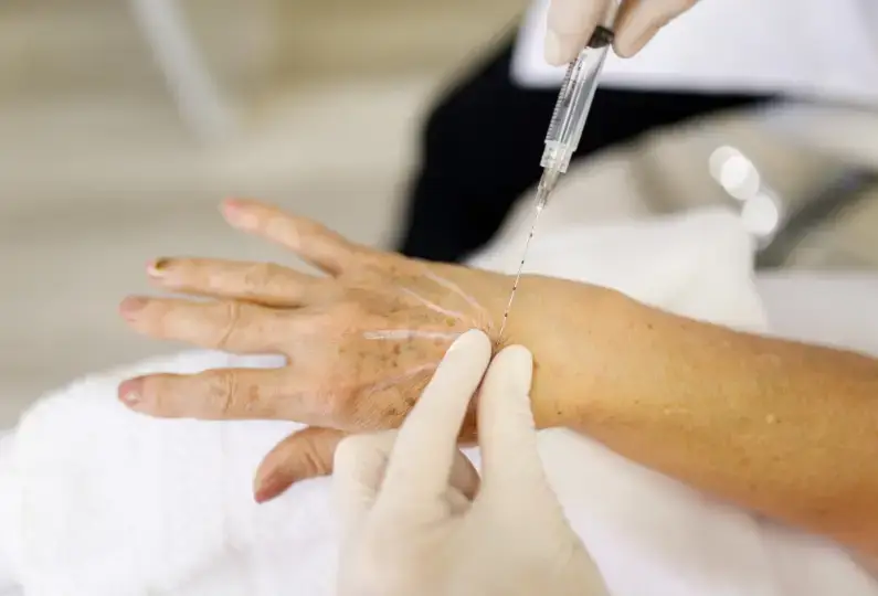 BIOESTIMULADOR MÃO. Na Clínica Terrace by Dra. Mara Marques, acreditamos que o cuidado com a pele e o corpo vai além da estética – é uma questão de saúde e bem-estar. Os tratamentos com bioestimuladores oferecem uma solução inovadora e eficaz para quem procura rejuvenescer, melhorar a firmeza da pele e até redefinir o contorno corporal.