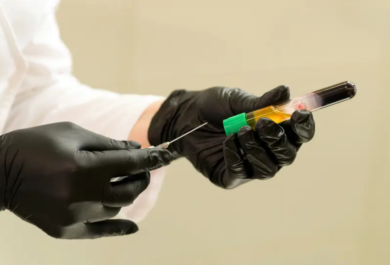 O PRP (Plasma Rico em Plaquetas) é uma terapia inovadora que utiliza os componentes do próprio sangue do paciente para estimular a regeneração e reparação dos tecidos. Este método baseia-se na concentração de plaquetas, que contêm fatores de crescimento essenciais para a recuperação celular e tecidular.
