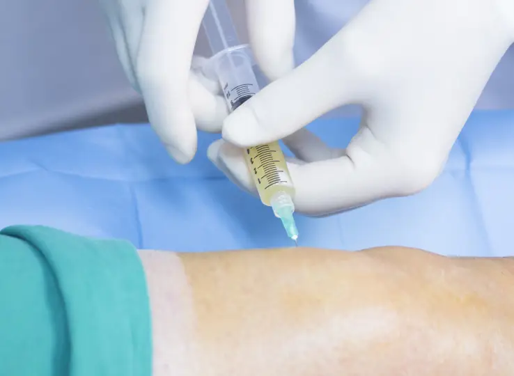 O PRP na Ortopedia é amplamente utilizado no tratamento de lesões musculares, tendinites, artrite e problemas articulares. Ajuda a reduzir a inflamação, aliviar a dor e acelerar a recuperação.
