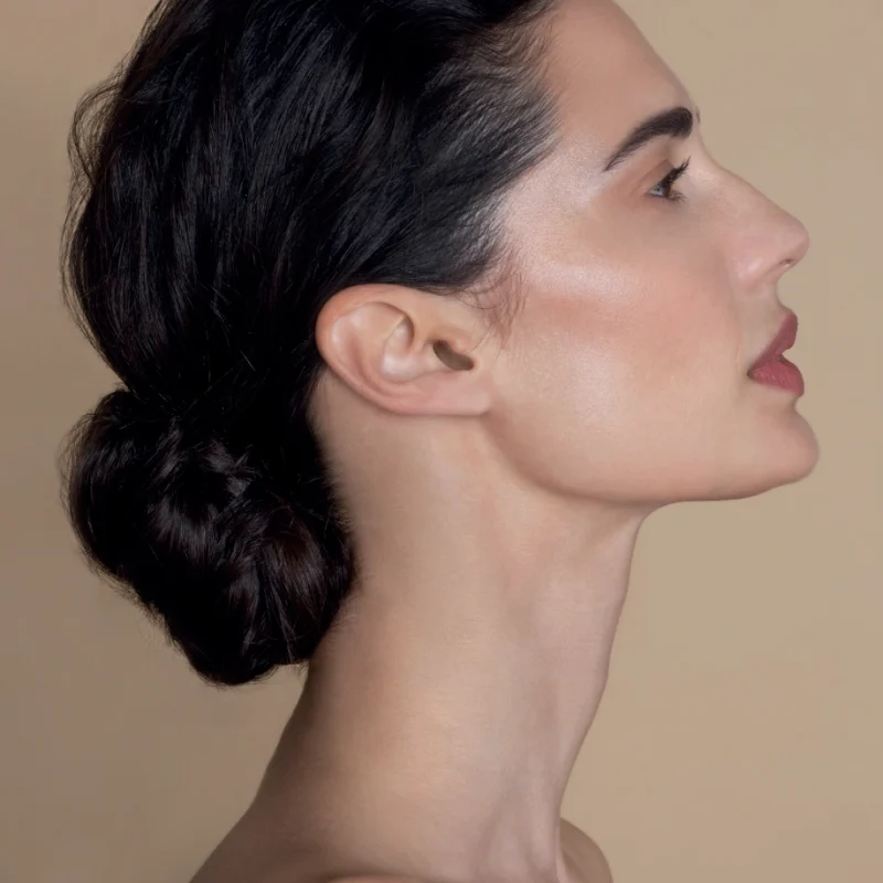 Prophilo é um ácido hialurónico ultrapuro de alto e baixo peso molecular em concentrações elevadas, sob a forma de complexos híbridos cooperativos (CHC), indicado para remodelação tecidual e melhoria da flacidez da pele do rosto e pescoço.